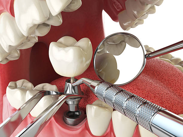 Best Same-Day Emergency Dentist in Overton, TX
