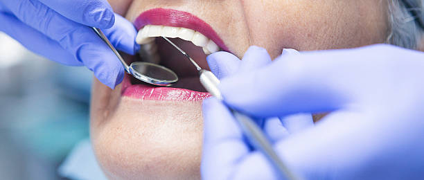Best Emergency Wisdom Teeth Removal in Overton, TX